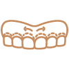 Cirurgia plástica gengival